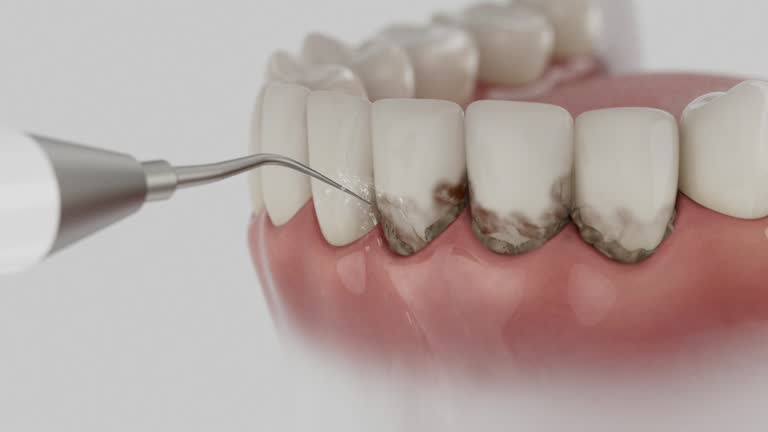 Reliable Dental Implants contractor in Ashland, OR by Smile Center Dentistry